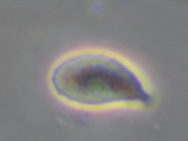 Botryobasidium con spore finemente verrucose